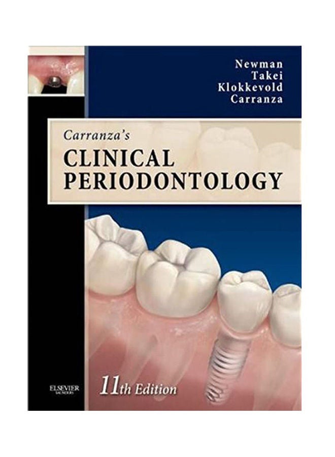 null - كتاب Carranza's Clinical Periodontology غلاف صلب الإنجليزية - 1984 - Image 1