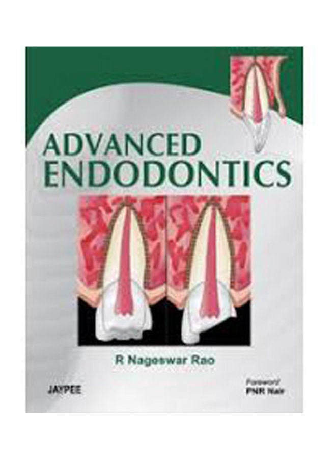 Advanced Endodontics Hardcover English by Rao - 2005 