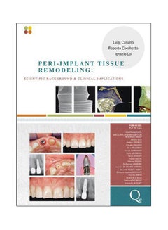 Peri - Implant Tissue Remodelling: Scientific Background & Clinical Implications Hardcover English by Canullo - 2012 