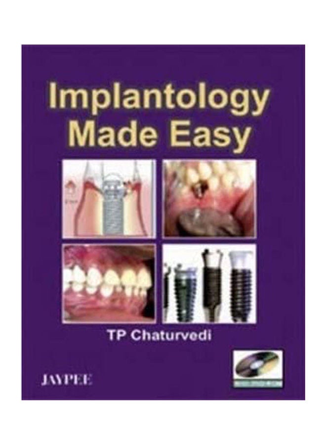 Implantology made easy With CD Rom Hardcover English by Chaturvedi - 2008 