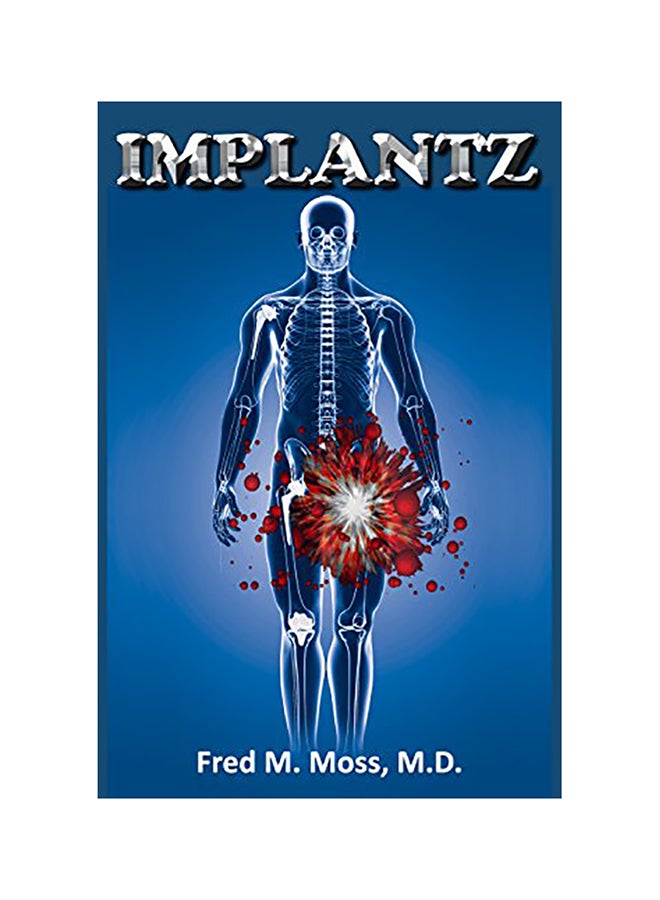 Implantz paperback english - 01-Jan-2016 