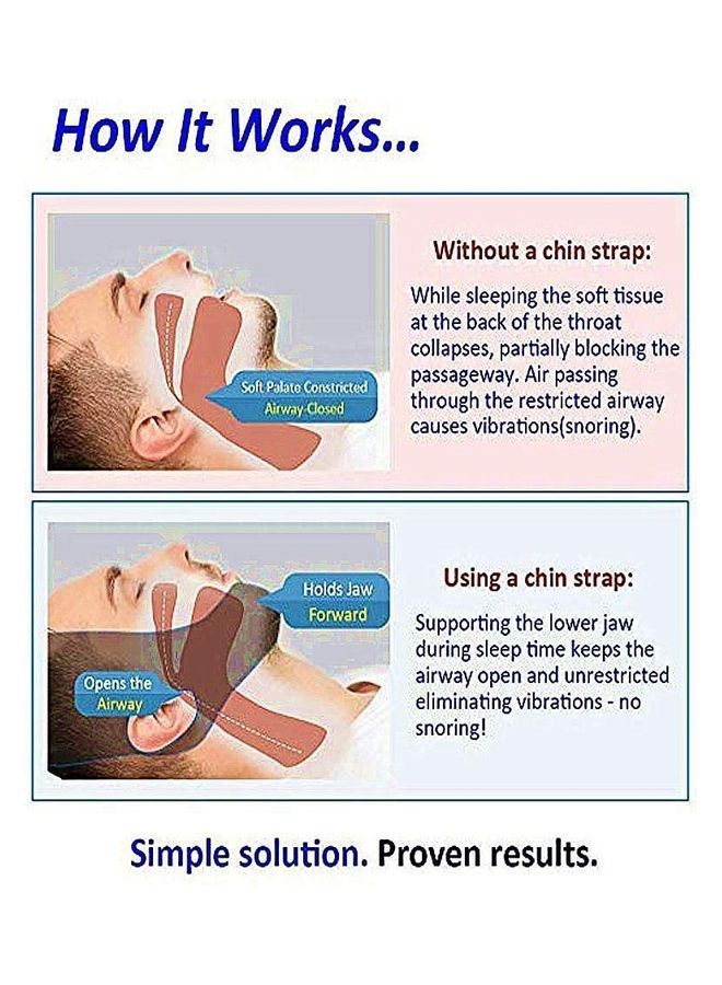 Generic - Chin Strap for Snoring Solution - Image 1