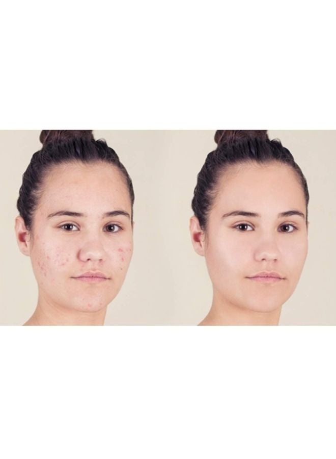 Neutrogena Skin Clearing Blemish Concealer 15 Medium  - Image 5