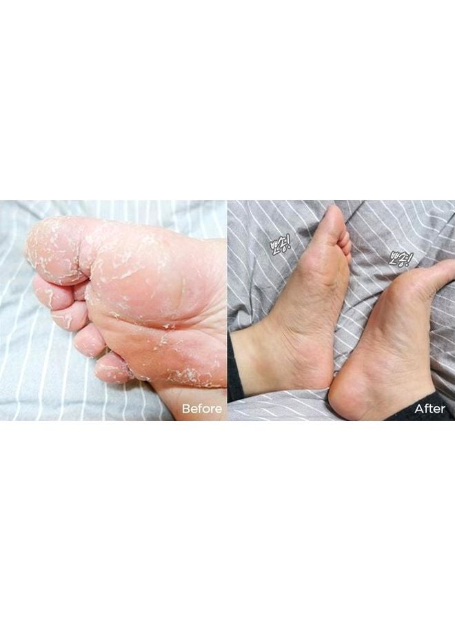 THE FACE SHOP Smile Foot Peeling Jelly Mask 40ml - Image 4