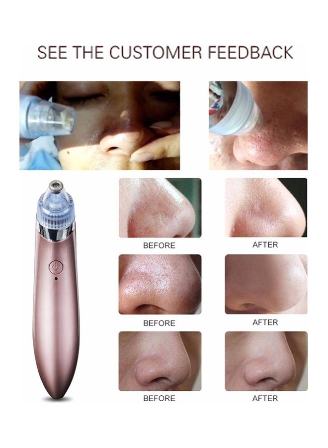 Kivalo Blackhead Remover Vacuum Suction Device Pink - Image 4