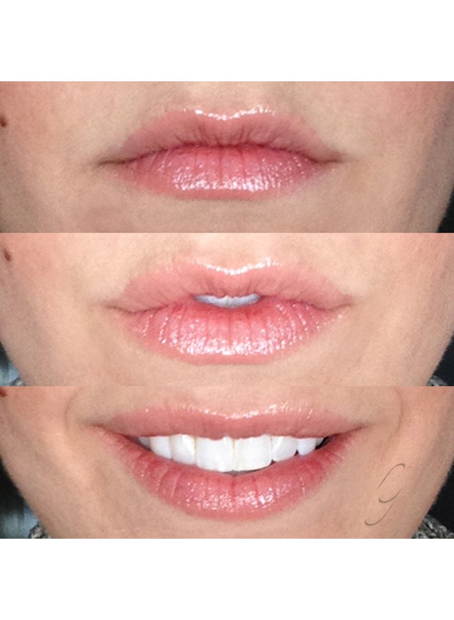 Vaseline 4-Piece Lip Therapy Balm Pink 7x4grams - Image 4