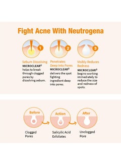 Neutrogena Microclear Oil-Free Acne Wash Yellow 269ml  - Image 4