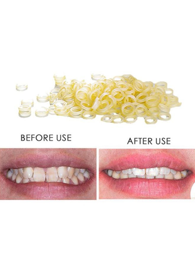 100 pcs Dental Rubber Bands Orthodontic Elastics Braces Teeth Gap Beige