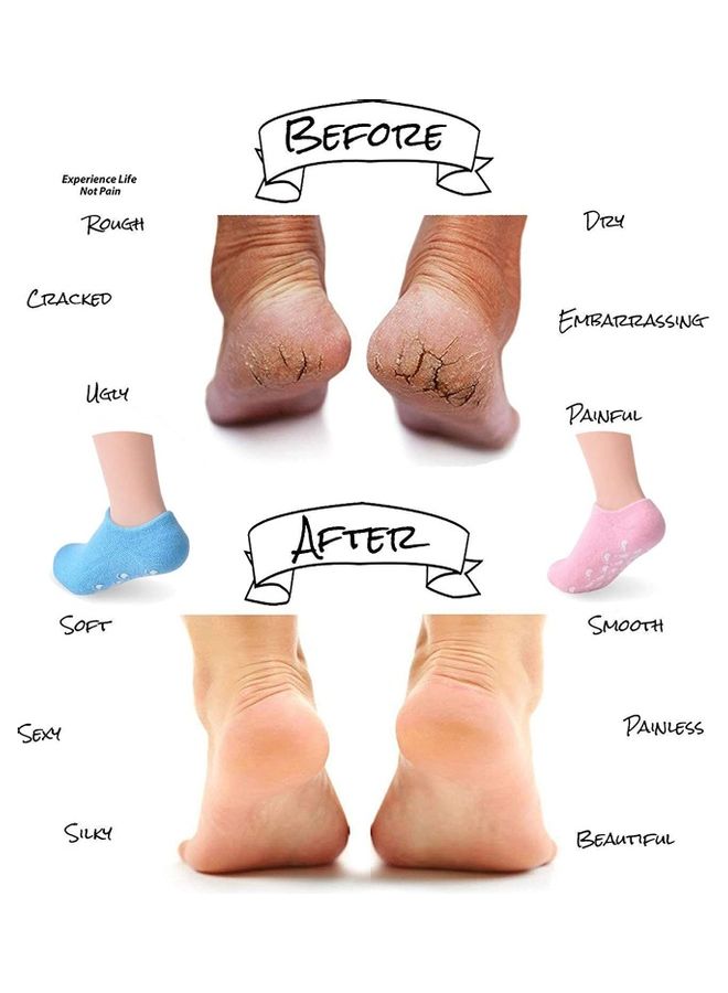 Toshionics Moisturizing Gel Spa Socks For Repairing and Softening Dry Cracked Feet - Image 3