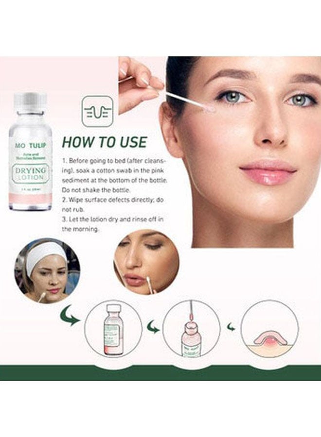 Anti-Acne Serum Clear 29ml