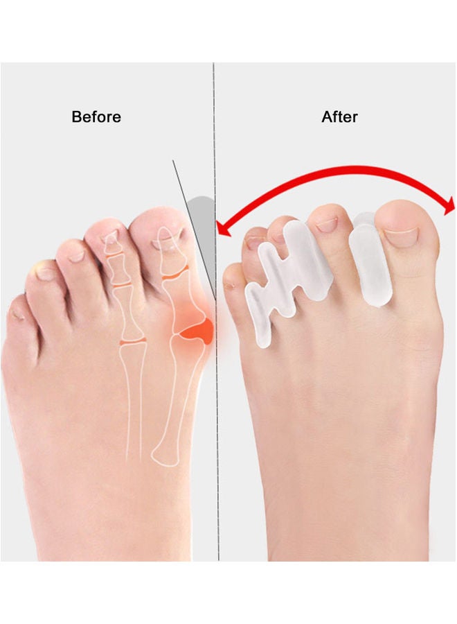 1 Pair Silicone Bunion Corrector Toe Treatment Set - Image 3