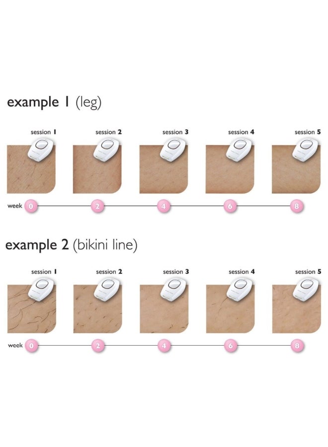روك بو جهاز متقدم لإزالة الشعر أبيض - Image 4