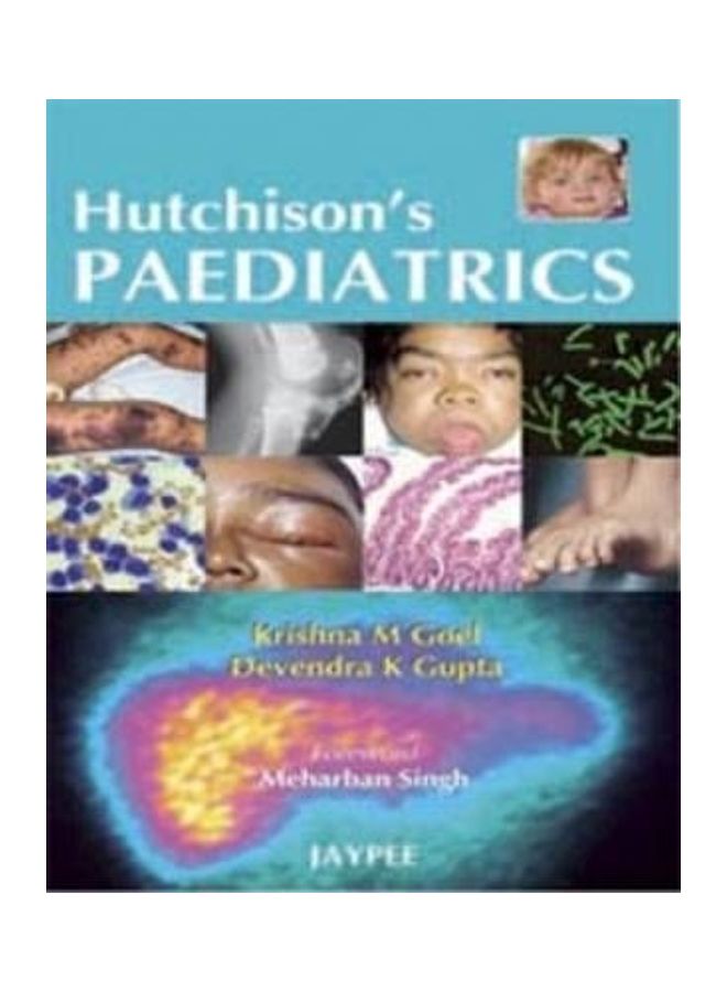 طب الأطفال هاتشيسون