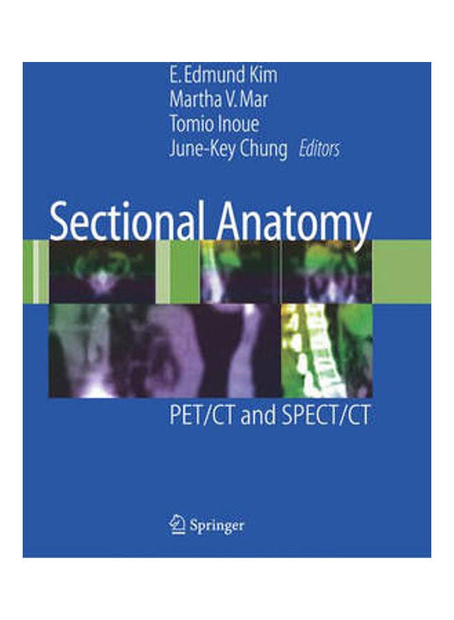تشريح مقطعي: PET/CT و SPECT/CT