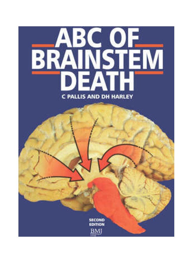 ألف باء الموت الدماغي السُفلي