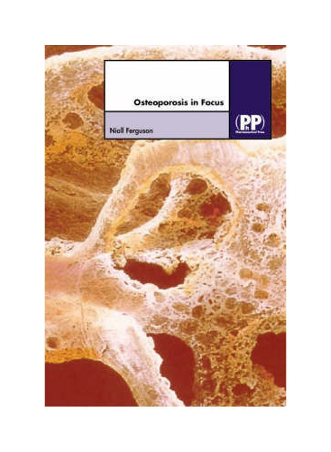 Osteoporosis In Focus Hardcover English by Niall Ferguson 