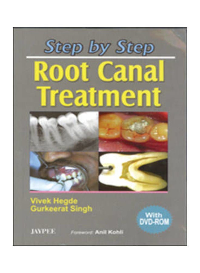 Step By Step: Root Canal Treatment Paperback English by Vivek Hegde 