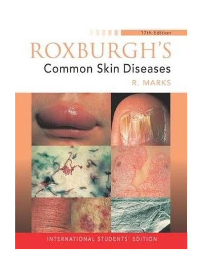 Roxburgh's Common Skin Diseases Paperback English by Ronald Marks