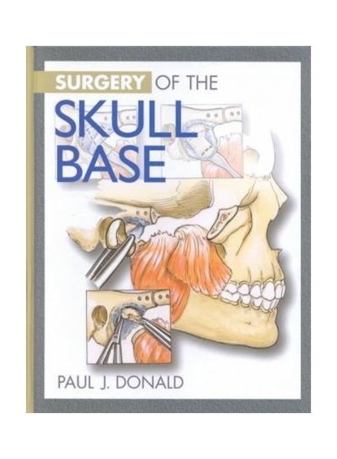 Surgery of the Skull Base Hardcover English by P.J. Donald