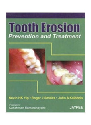 Tooth Erosion Prevention And Treatment Hardcover English by Kevin HK Yip - v1621829915/N47580959A_1