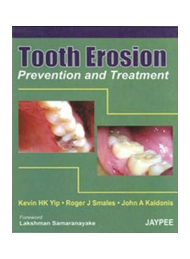 null - Tooth Erosion Prevention And Treatment Hardcover English by Kevin HK Yip - Image 1