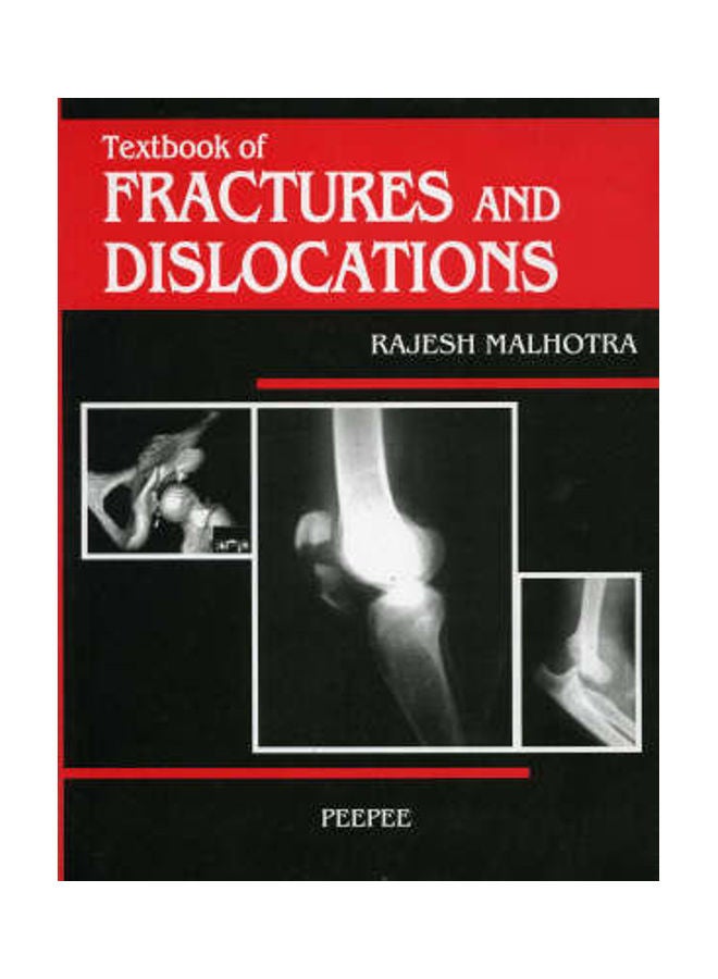 Textbook Of Fractures And Dislocations Paperback English by Rajesh Malhotra 