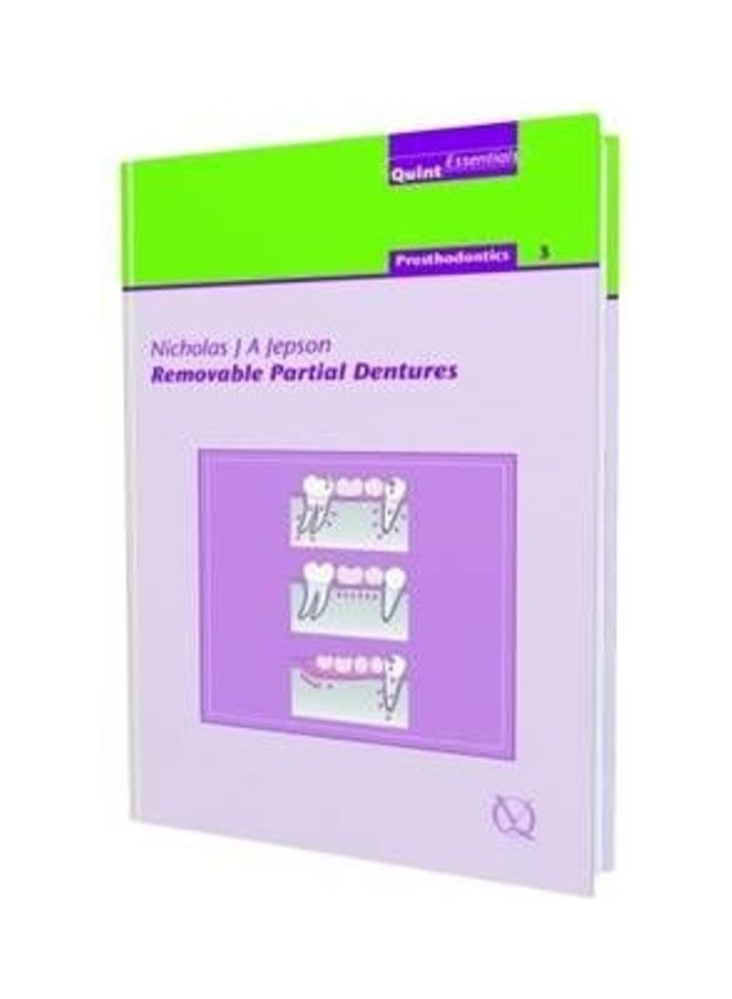 Removable Partial Dentures Hardcover English by P. Finbarr Allen