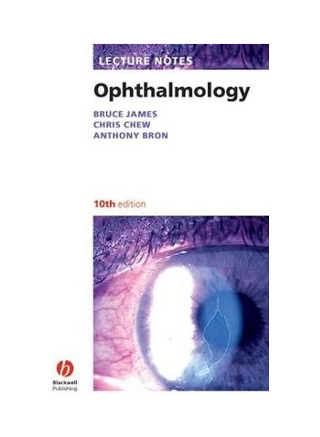 Lecture Notes: Ophthalmology Paperback English by Bruce James