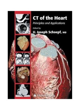 Ct Of The Heart Hardcover English by U. Joseph Schoepf - v1621830136/N47583402A_1