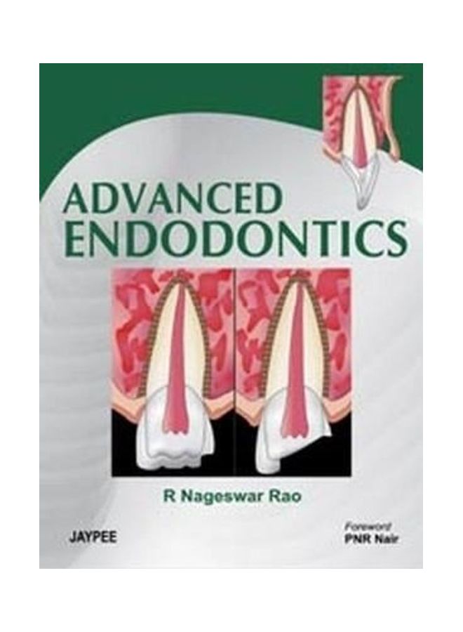 Advanced Endodontics Hardcover English by R Nageswar Rao 