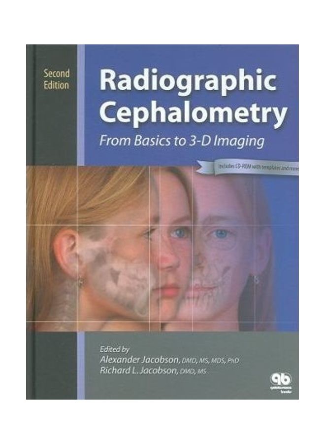 null - Radiographic Cephalometry Hardcover English by Alex Jacobson - Image 1