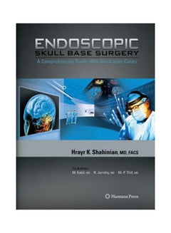 Endoscopic Skull Base Surgery hardcover english - v1621830279/N47583403A_1