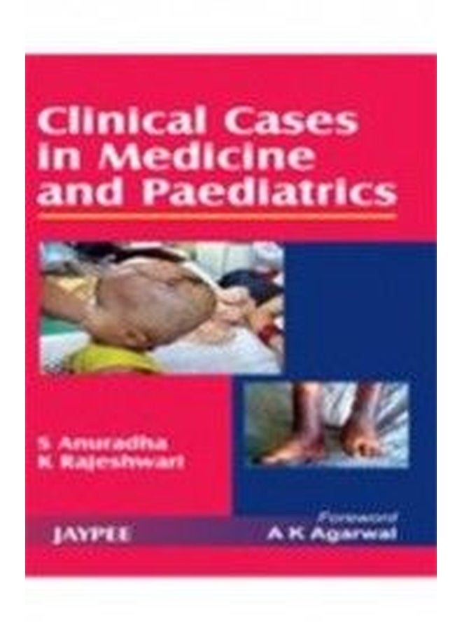 حالات سريرية في الطب وطب الأطفال