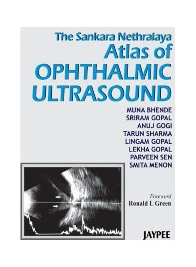 Atlas of Ophthalmic Ultrasound Hardcover English by M. Bhende