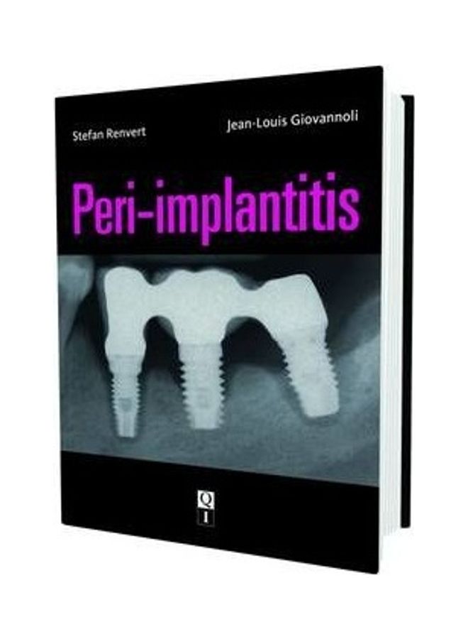Peri-implantitis Hardcover English by Stefan Renvert