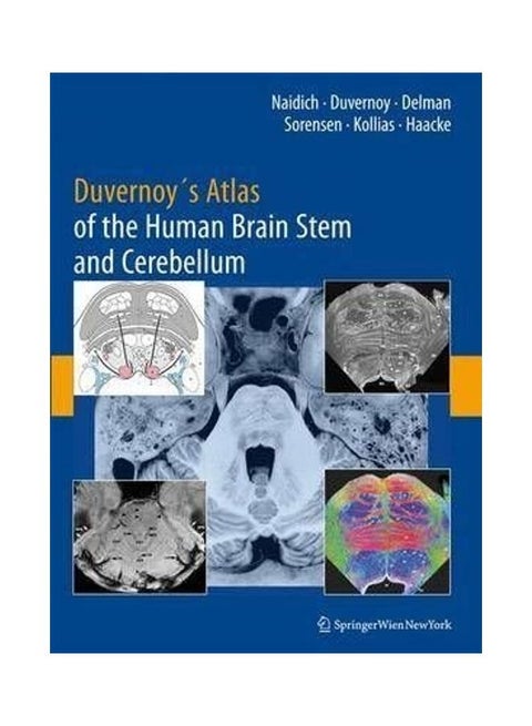 Duvernoy's Atlas of the Human Brain Stem and Cerebellum: High-field MRI, Surface Anatomy, Internal Structure, Vascularization and 3D Sectional Anatomy Hardcover English by Thomas P. Naidich