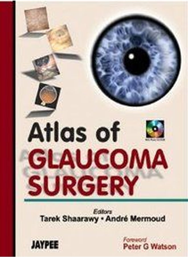 Atlas of Glaucoma Surgery Paperback English