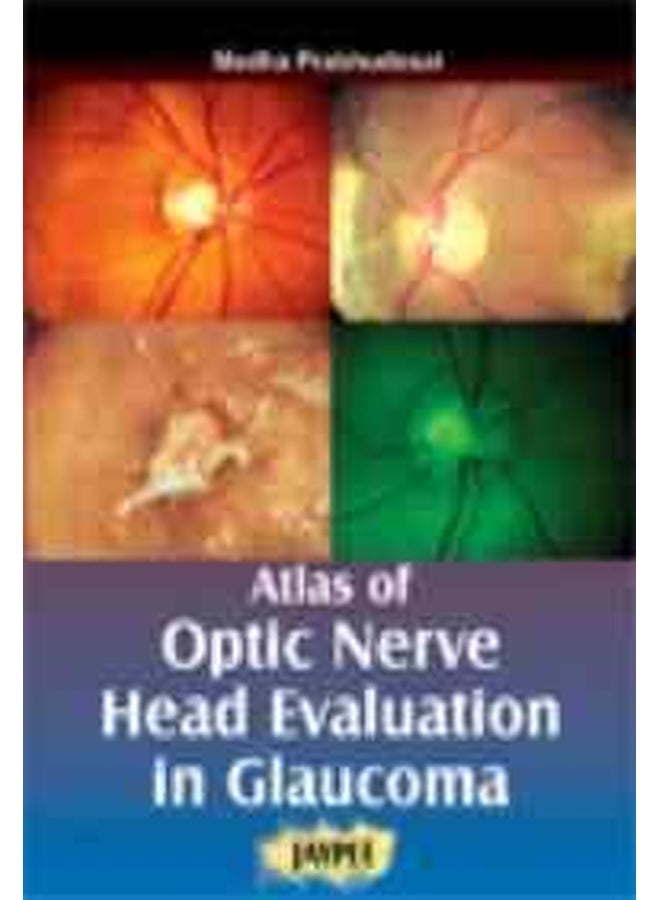Atlas of Optic Nerve Head Evaluation in Glocauma Hardcover English by Medha Prabhudesai - 39052.0