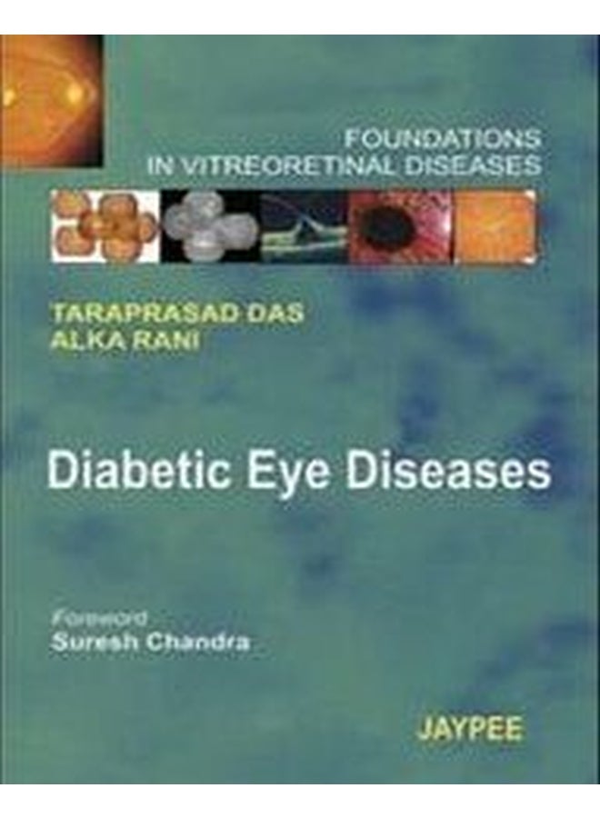 Diabetic: Eye Diseases - Foundations in Vitreoretina Hardcover English by Rani Das - 39052.0 