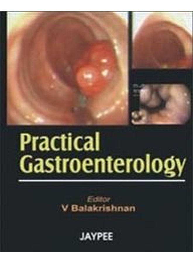 Practical Gastroenterology: 2007 Paperback English 