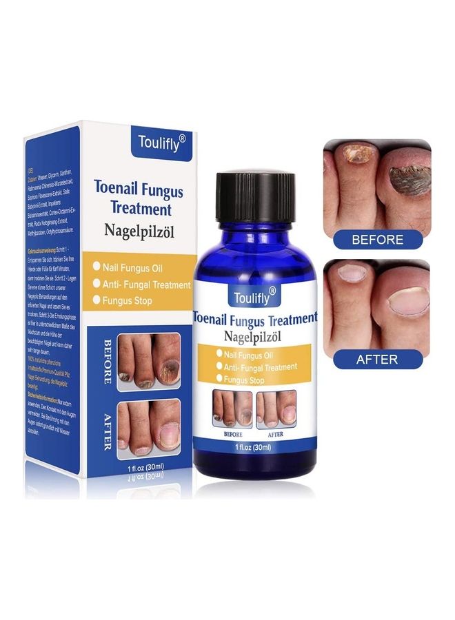 TOULIFLY Toenail Fungus Treatment Multicolour 30ml - Image 1