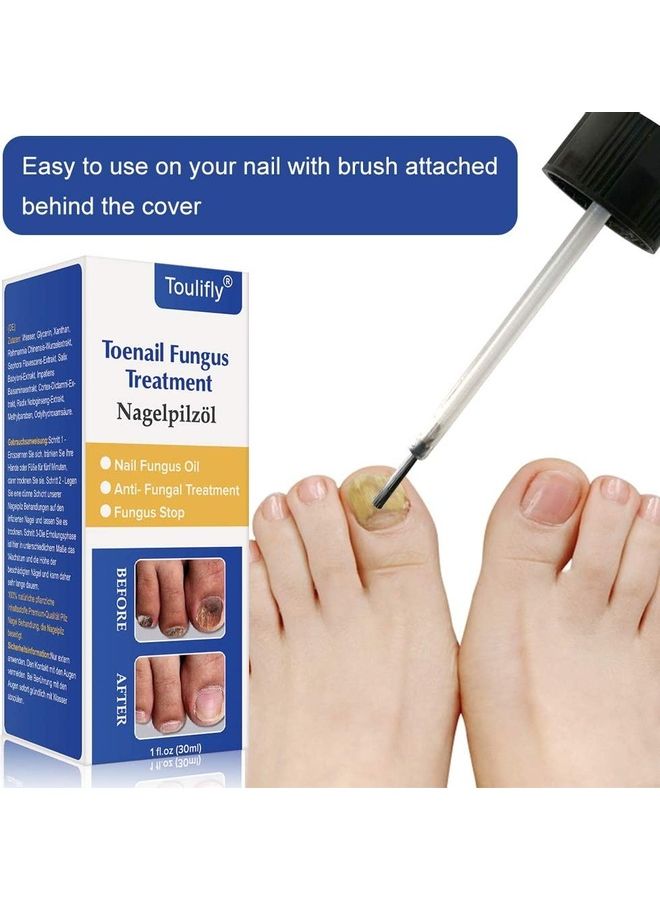 TOULIFLY Toenail Fungus Treatment Multicolour 30ml - Image 2