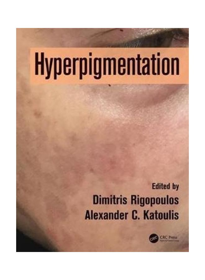 Hyperpigmentation paperback english 