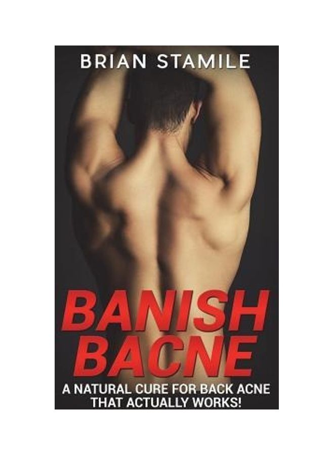 Banish Bacne Paperback English by Brian Stamile - 43298