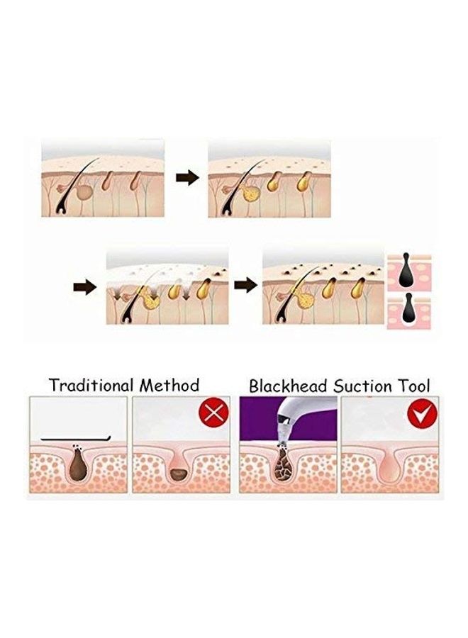 Hemiza Multi-Function Blackhead Remover Rose Gold 2 X 2.2 X 1.9inch - Image 5