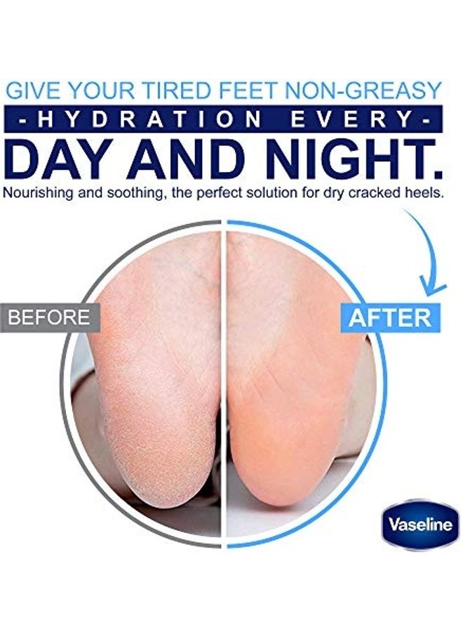 Vaseline - Deep Moisture Foot Cream For Dry Cracked Feet & Heel Multicolour - Image 1