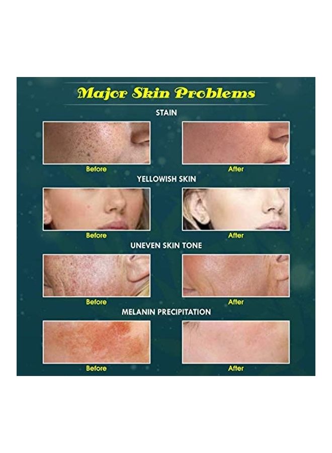 EARTH THERAPY - Fairness Cream Clear 50grams - Image 1