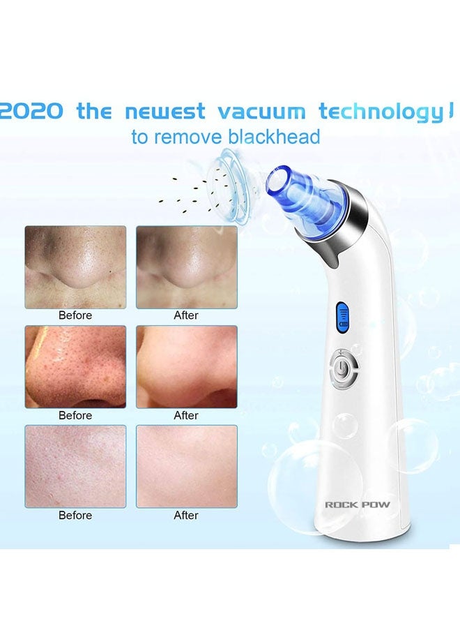 Rock Pow Blackhead Remover Vacuum - Facial Pore Cleanser White - Image 4
