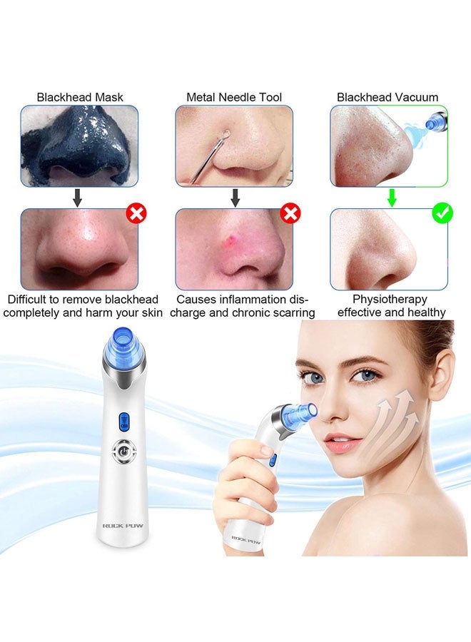 Rock Pow Blackhead Remover Vacuum - Facial Pore Cleanser White - Image 3