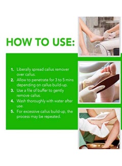 Mira Callus Remover 1000ml  - Image 4